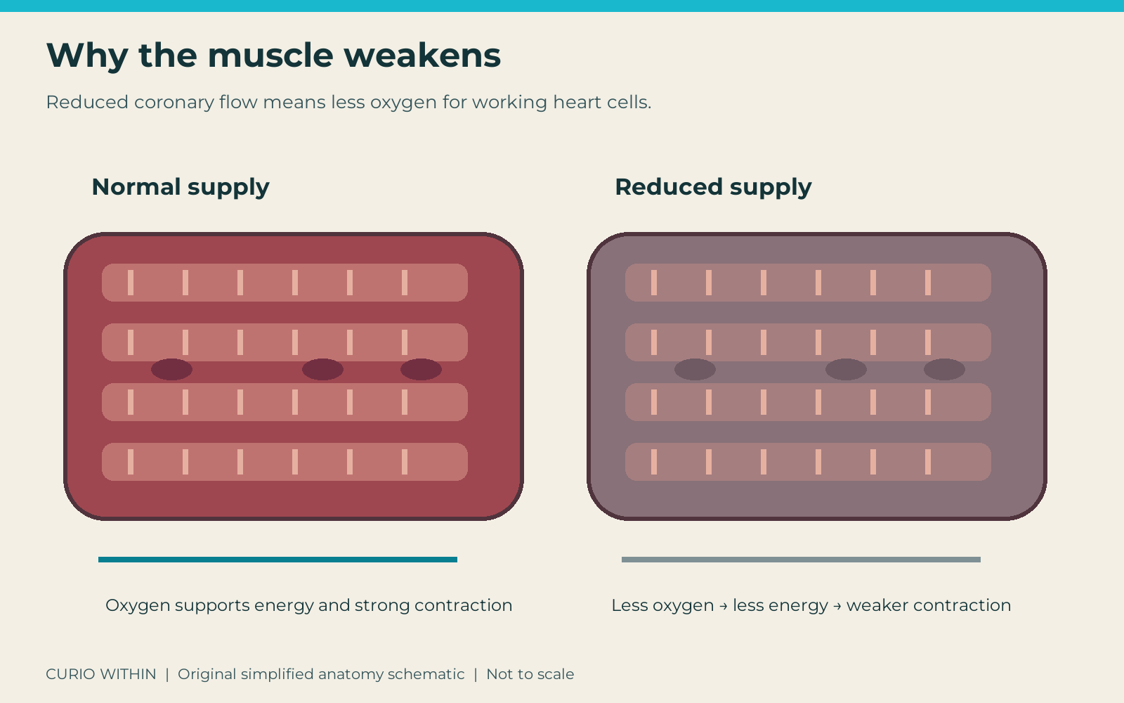 Simplified comparison of normally supplied heart muscle and reduced-supply muscle, showing the relationship between oxygen, cellular energy and contraction