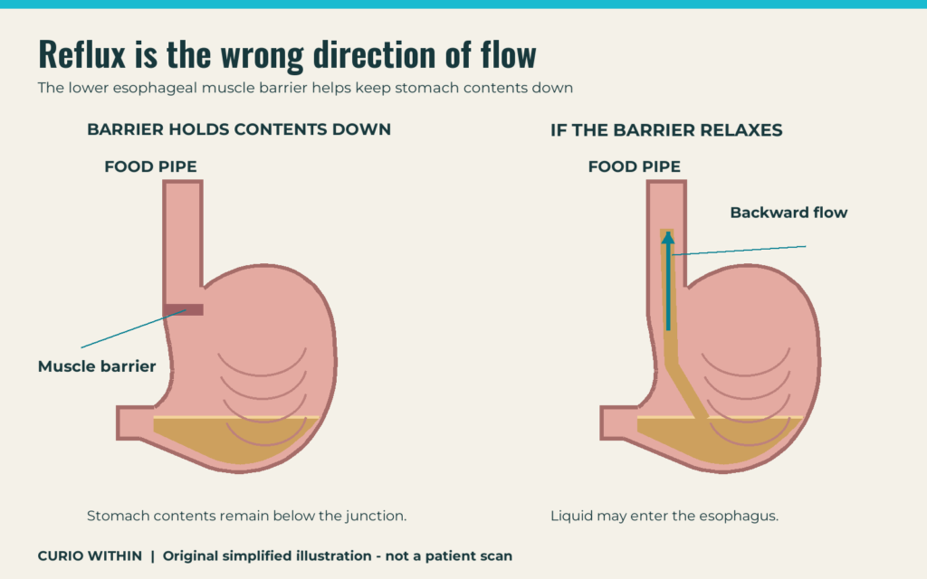 Why acid reflux gets worse when you lie down at night